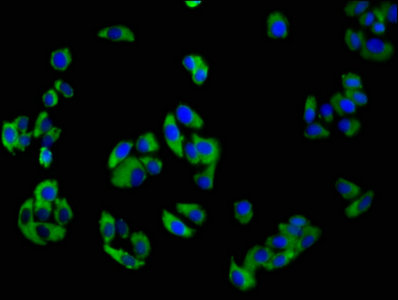 CSB-PA015551LA01HU