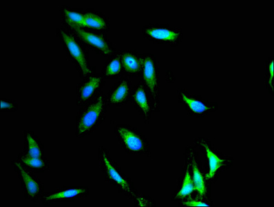 CSB-PA011879ESR1HU