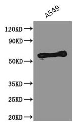 CSB-MA134471A0m