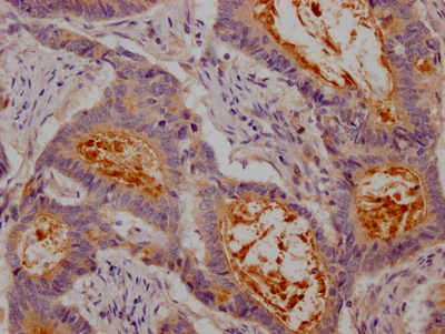 CSB-RA147192A0HU IHC
